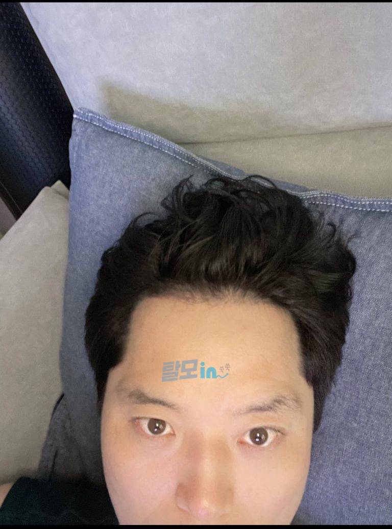 핀주브 300정 photo review