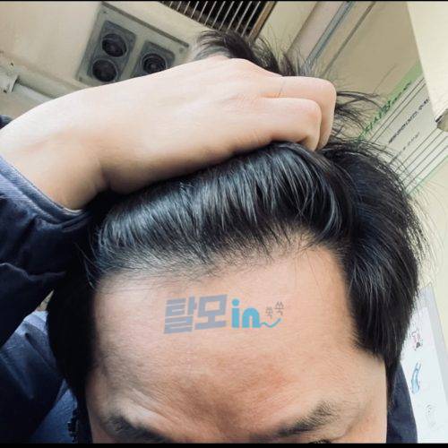 핀주브 300정 photo review