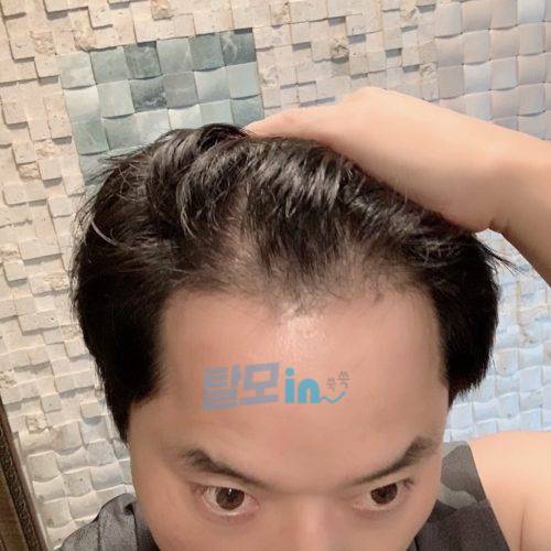 핀주브 300정 photo review