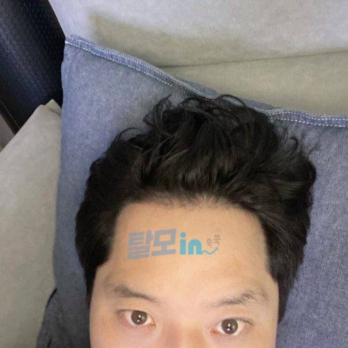 핀주브 300정 photo review