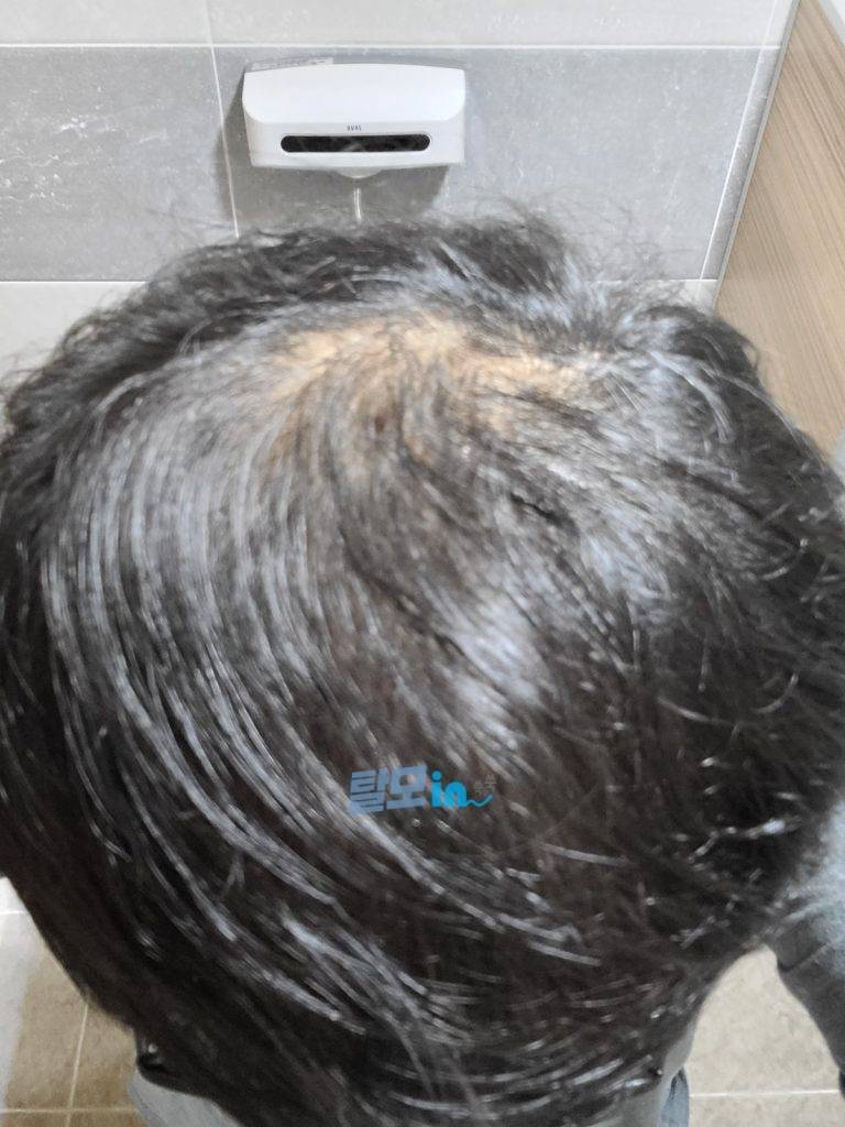 핀페시아 300정 photo review