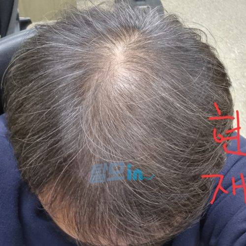 핀페시아 300정 photo review