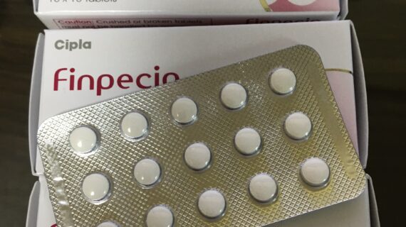 핀페시아 300정 photo review