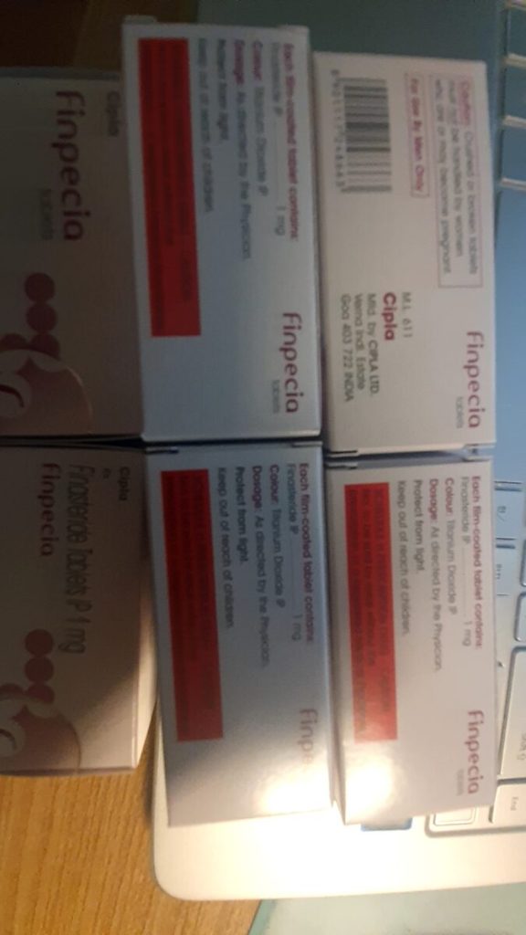 탈모인 탈무 Talmoo 후기 모음 photo review