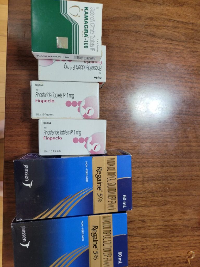 탈모인 탈무 Talmoo 후기 모음 photo review