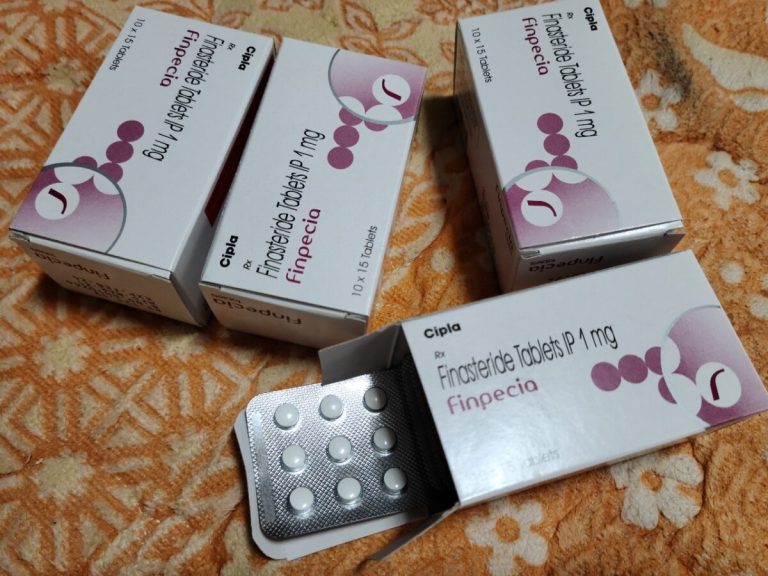 탈모인 탈무 Talmoo 후기 모음 photo review