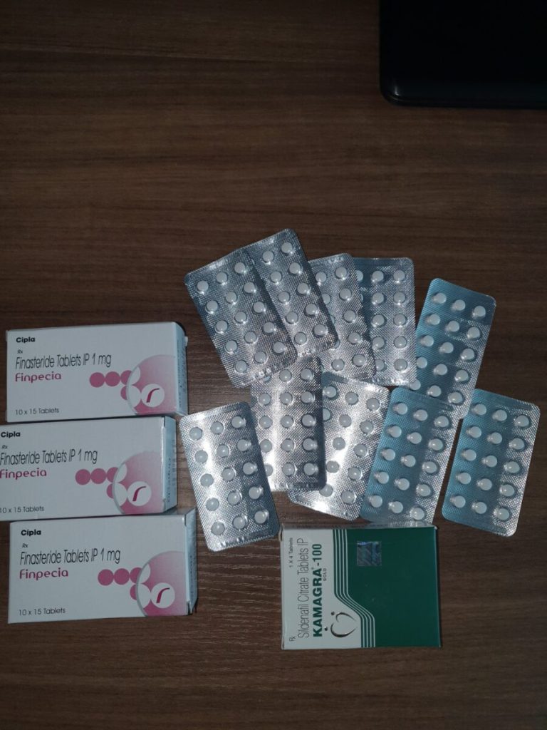 탈모인 탈무 Talmoo 후기 모음 photo review