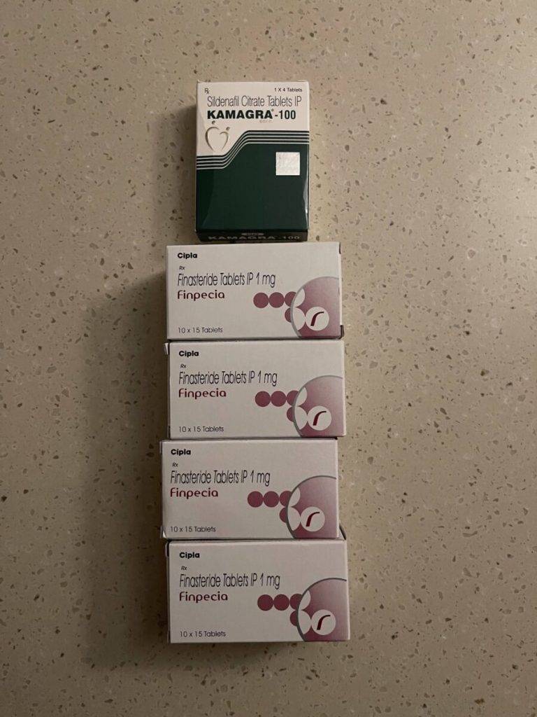 탈모인 탈무 Talmoo 후기 모음 photo review