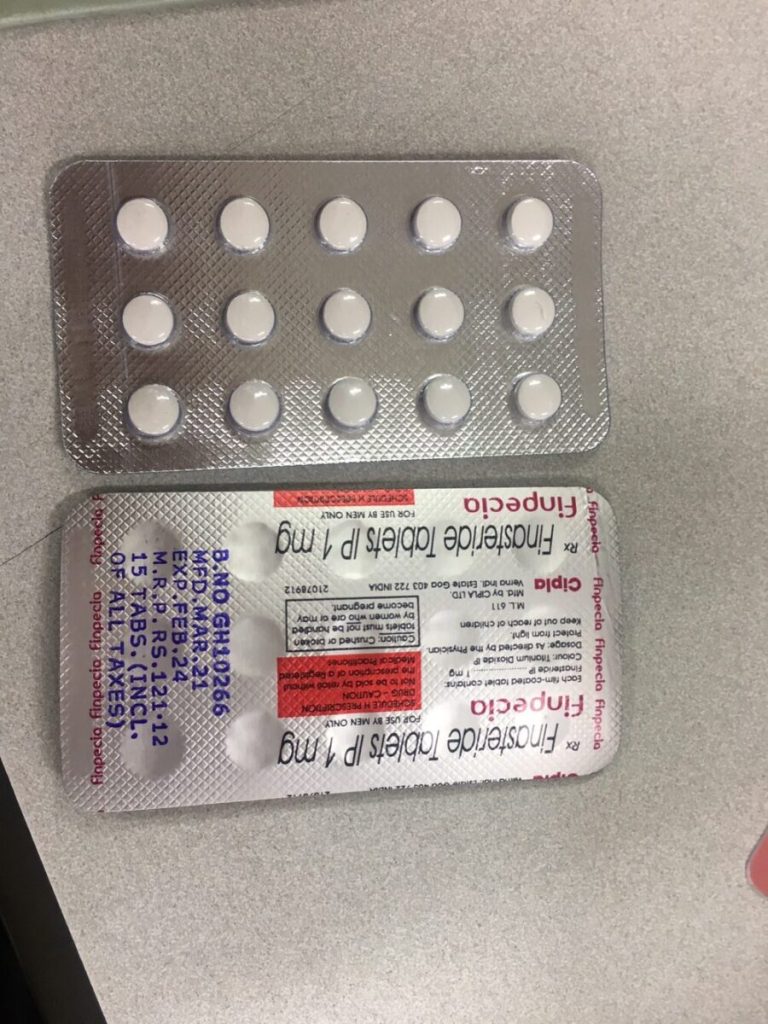 탈모인 탈무 Talmoo 후기 모음 photo review