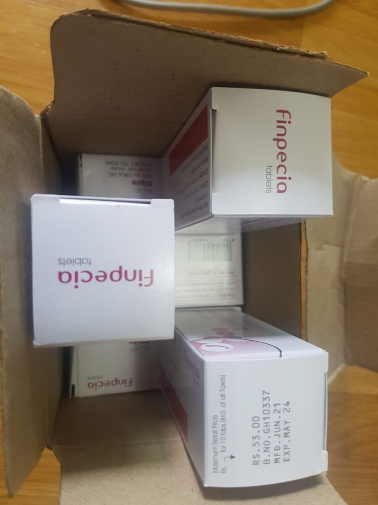 탈모인 탈무 Talmoo 후기 모음 photo review