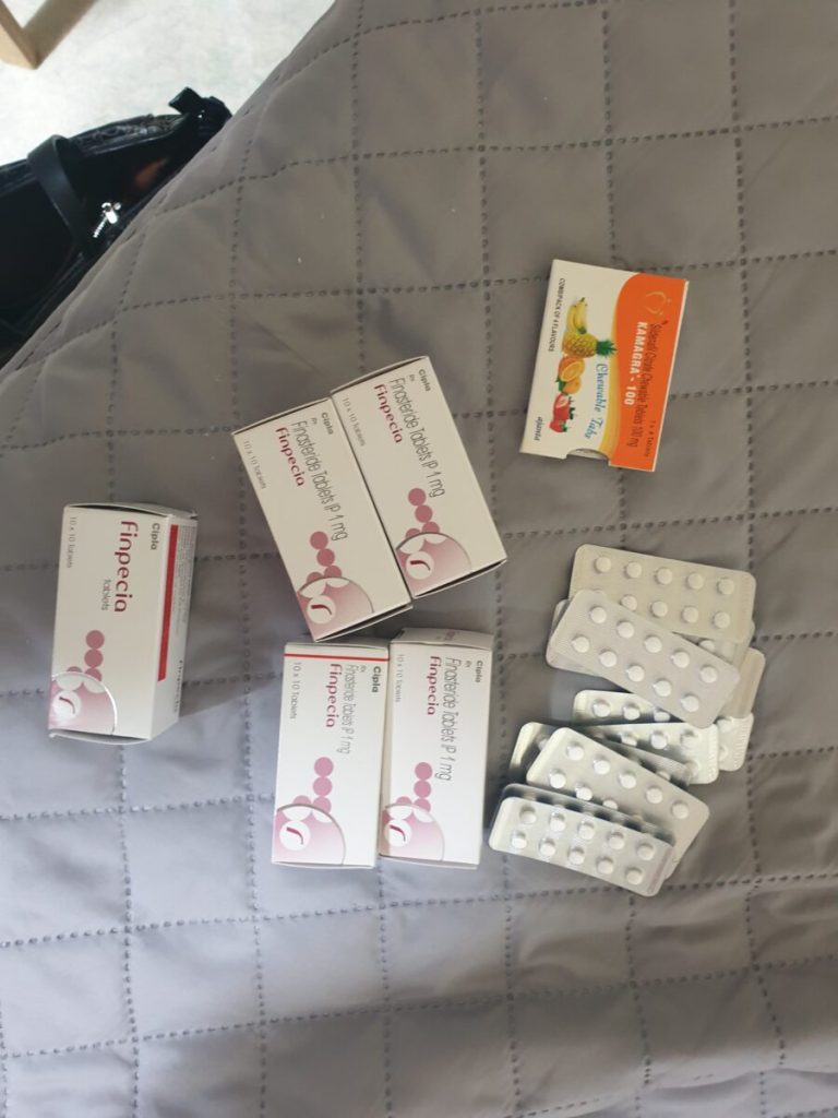 탈모인 탈무 Talmoo 후기 모음 photo review