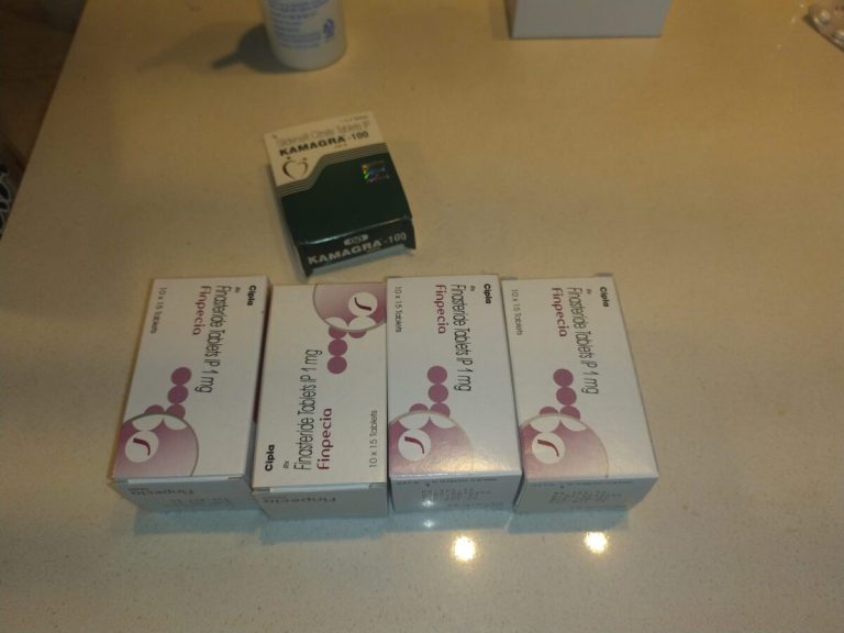 탈모인 탈무 Talmoo 후기 모음 photo review