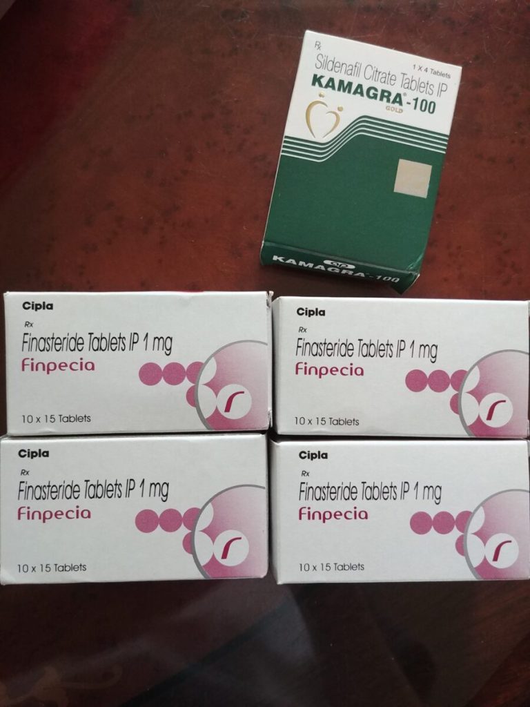 탈모인 탈무 Talmoo 후기 모음 photo review