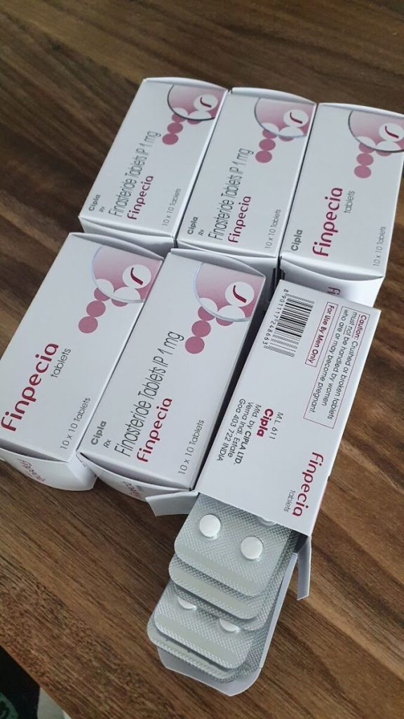 탈모인 탈무 Talmoo 후기 모음 photo review