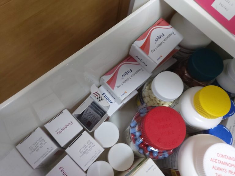 탈모인 탈무 Talmoo 후기 모음 photo review