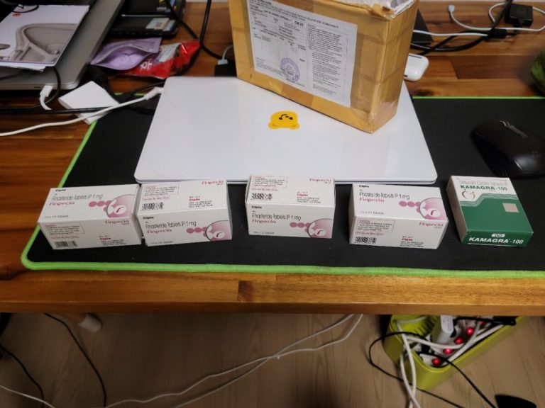 탈모인 탈무 Talmoo 후기 모음 photo review