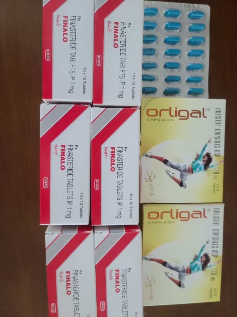 탈모인 탈무 Talmoo 후기 모음 photo review