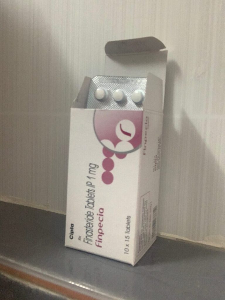 탈모인 탈무 Talmoo 후기 모음 photo review