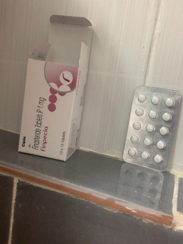 탈모인 탈무 Talmoo 후기 모음 photo review