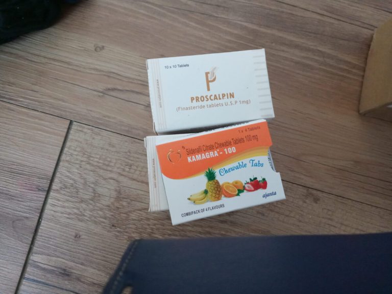 탈모인 탈무 Talmoo 후기 모음 photo review