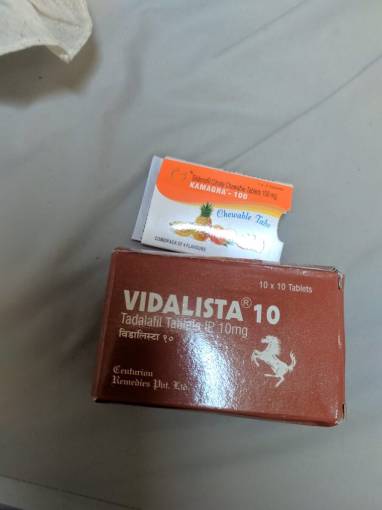 탈모인 탈무 Talmoo 후기 모음 photo review