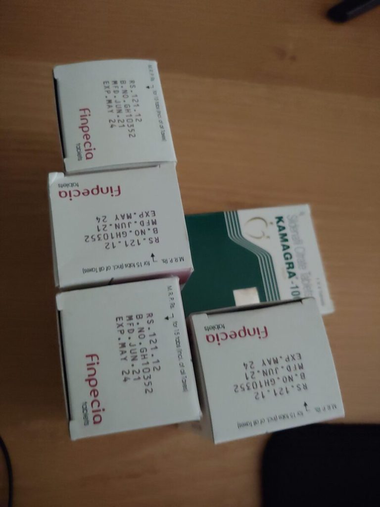 탈모인 탈무 Talmoo 후기 모음 photo review