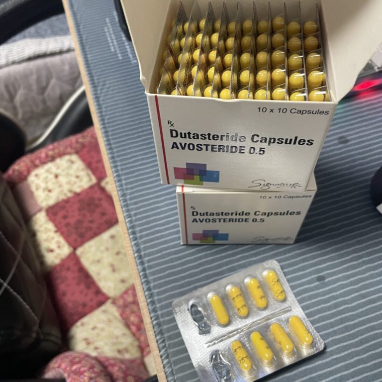 탈모인 탈무 Talmoo 후기 모음 photo review