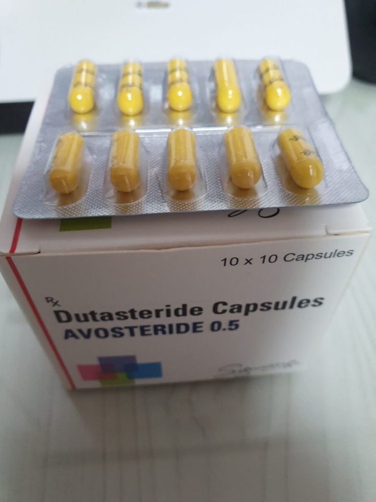 탈모인 탈무 Talmoo 후기 모음 photo review