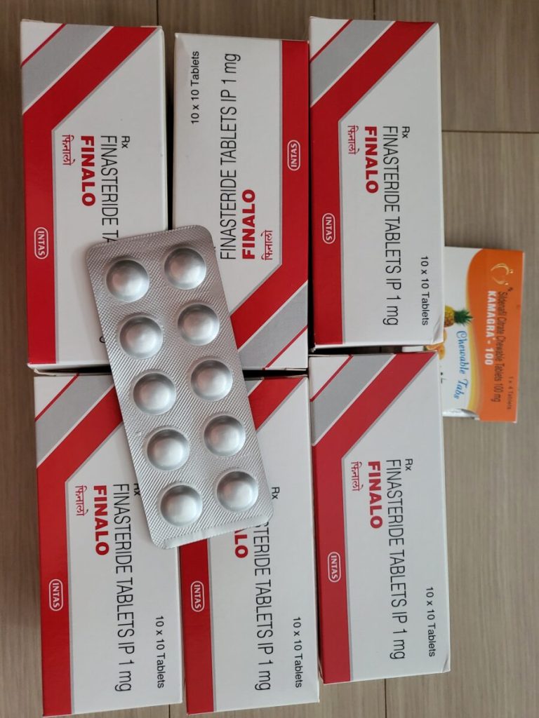 탈모인 탈무 Talmoo 후기 모음 photo review