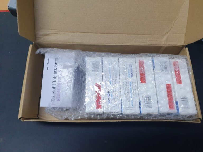 탈모인 탈무 Talmoo 후기 모음 photo review