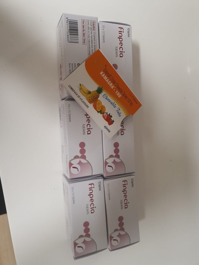 탈모인 탈무 Talmoo 후기 모음 photo review