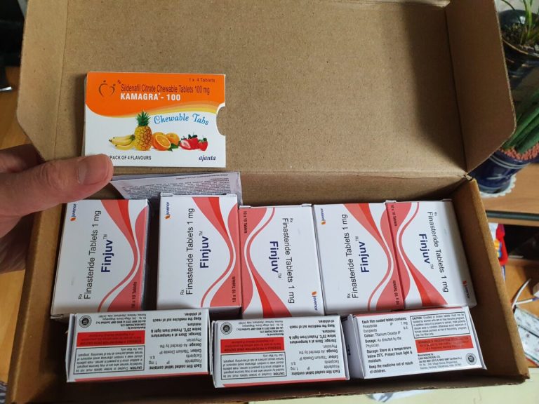 탈모인 탈무 Talmoo 후기 모음 photo review