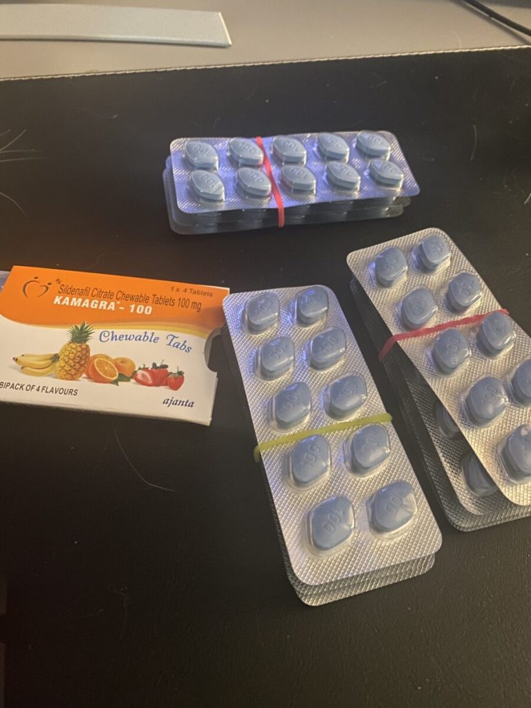 탈모인 탈무 Talmoo 후기 모음 photo review