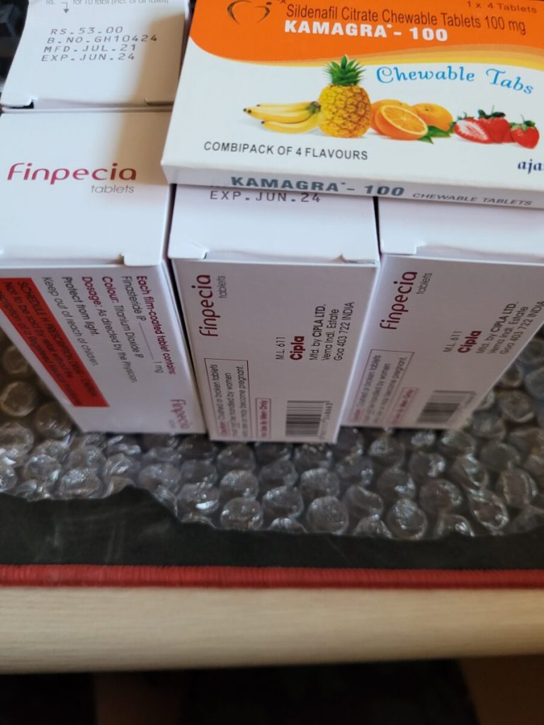 탈모인 탈무 Talmoo 후기 모음 photo review