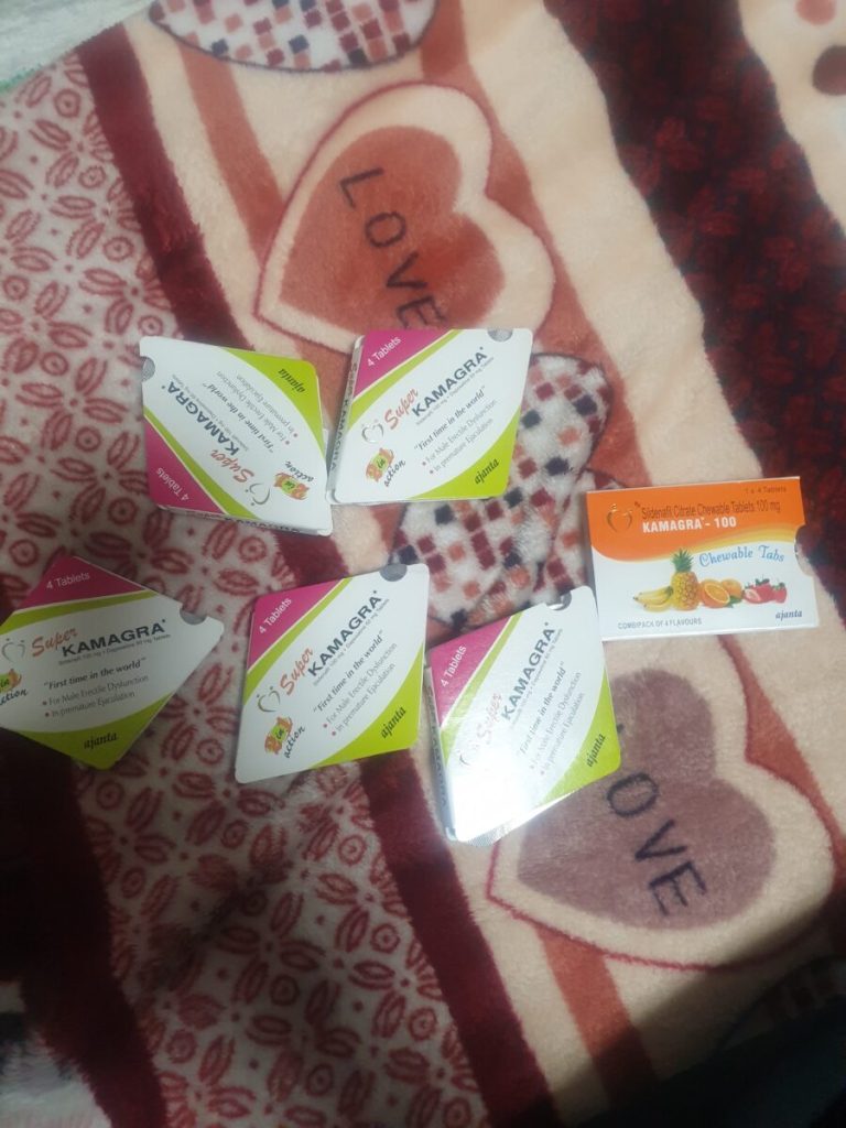 탈모인 탈무 Talmoo 후기 모음 photo review