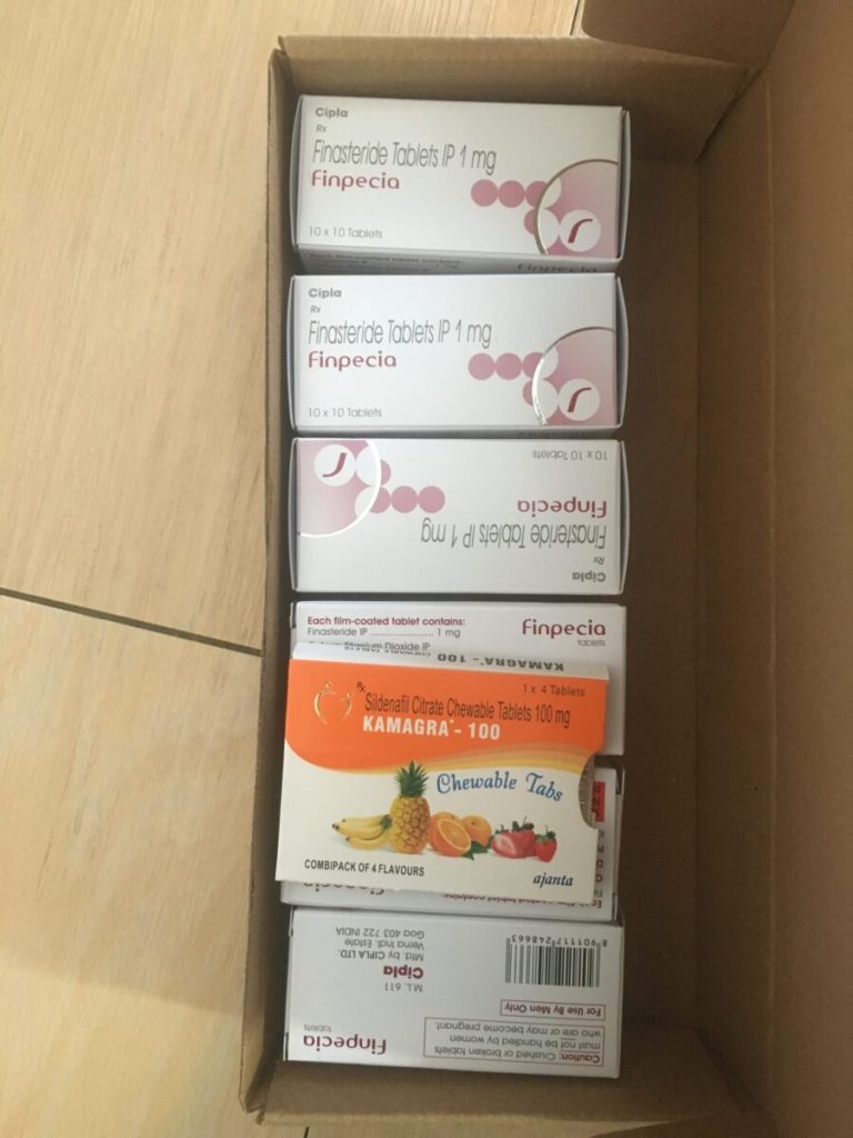 탈모인 탈무 Talmoo 후기 모음 photo review