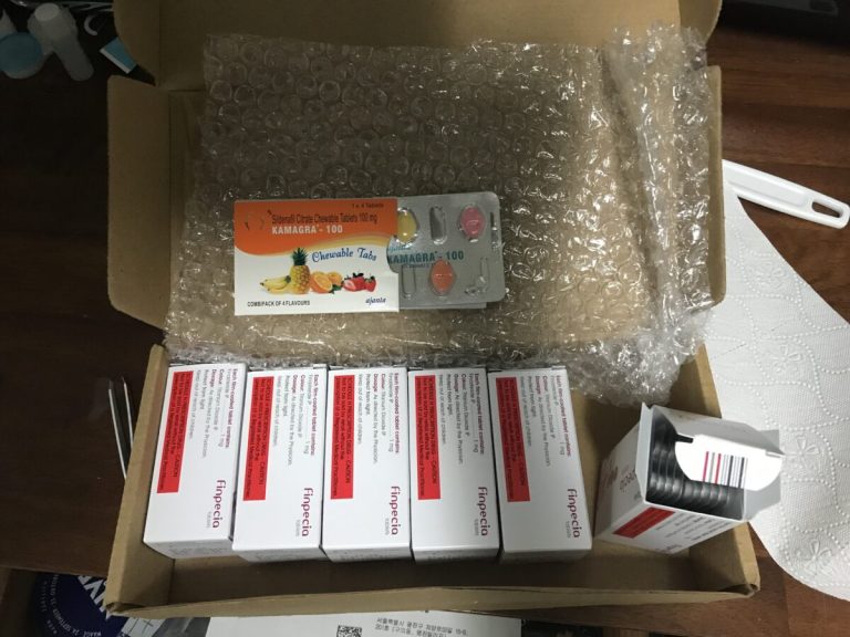 탈모인 탈무 Talmoo 후기 모음 photo review