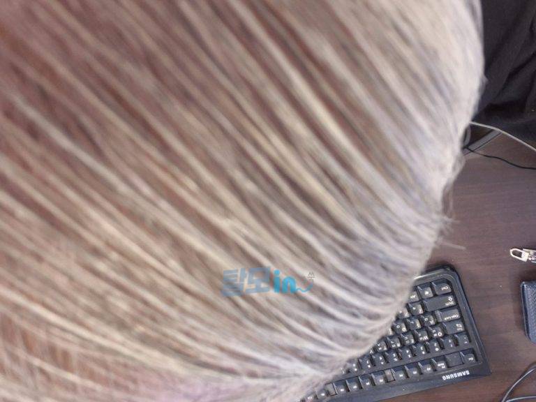 핀레스트1mg 300정 photo review